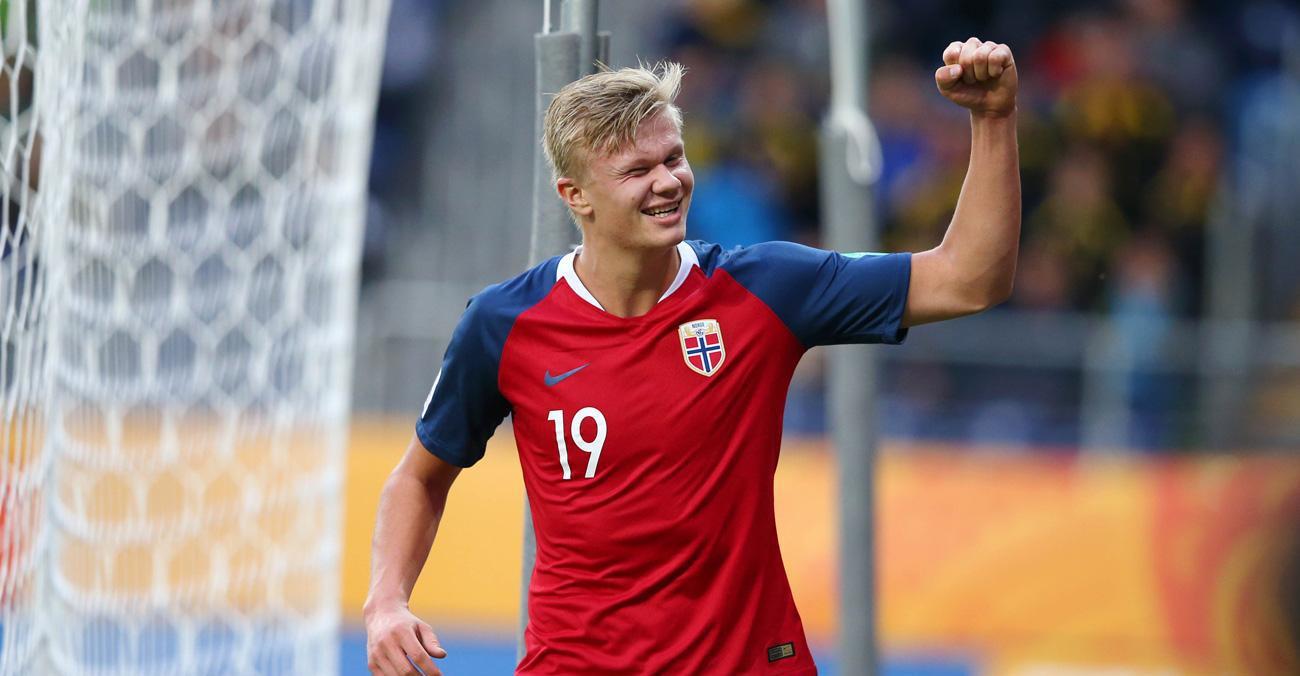 收缩肘区 收缩肘区